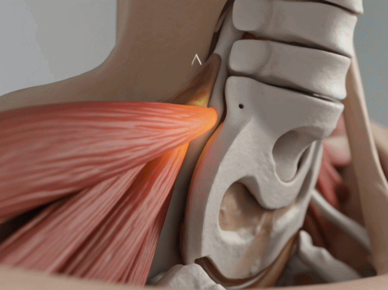 Give your neck room to breathe again